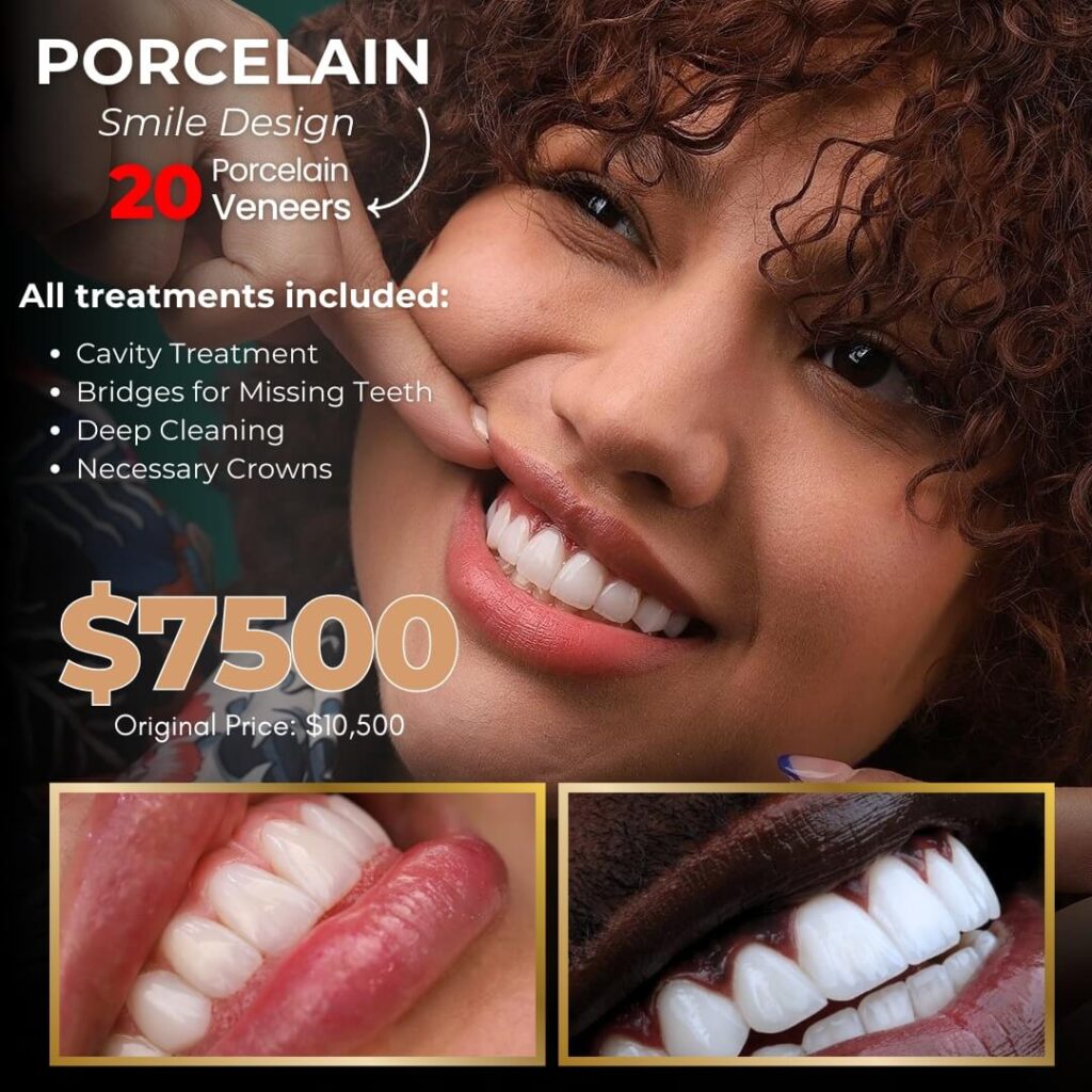 Porcelain Venners Ads