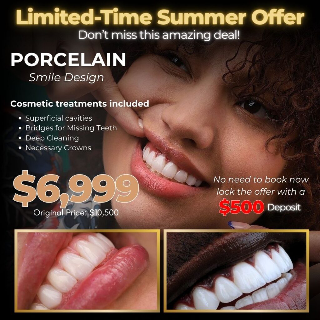 Just Smile - Porcelain Veneers ADs