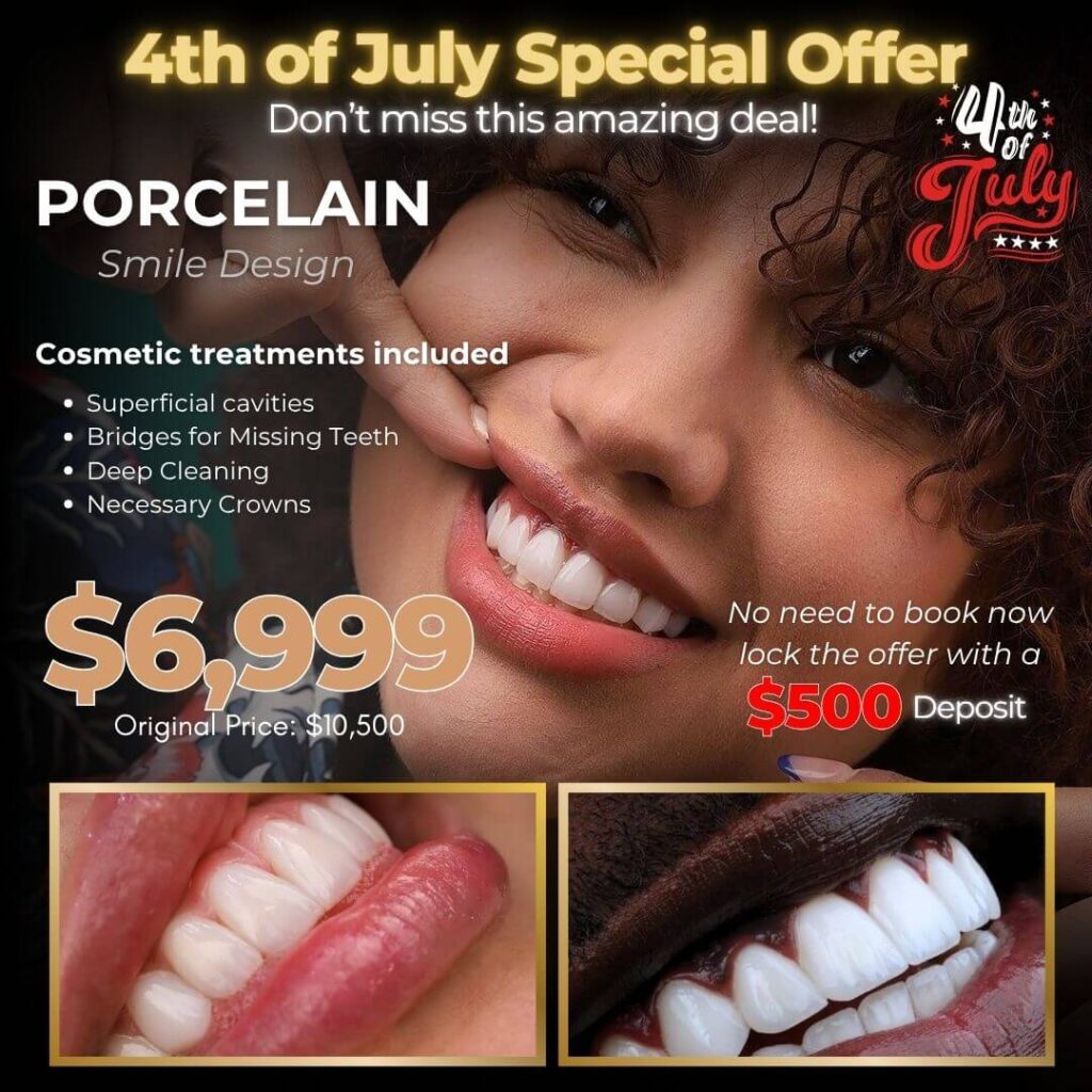 Porcelain Veneers - Just Smile v3